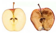 等离子除皱是什么？射频除皱果对比图片|保持时间分享~