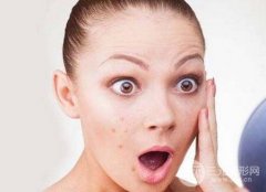 怎么样去痘坑？激光去痘坑的果好不好？注意事项解析！