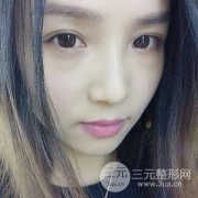 北京玻尿酸丰唇珠要多少钱|附上前后对比照片分享 北京玻尿酸丰唇珠要多少钱|附上前后对比照片分享