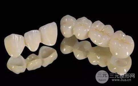 烤瓷牙有哪些种类、烤瓷牙多少钱一颗