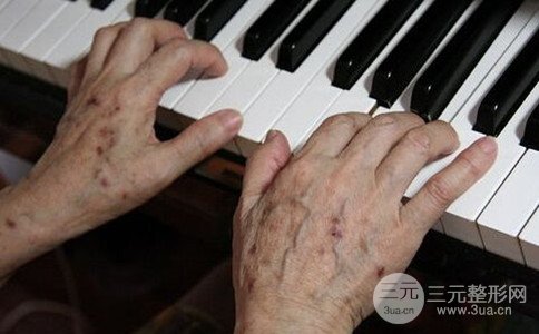 老年斑怎么去、去除老年斑需要多少钱