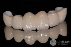 钛合金烤瓷牙套价格是多少钱？金属烤瓷牙哪种材质的喜欢？