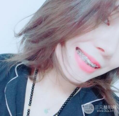 天包地矫正前后图片 天包地矫正步骤效果照片