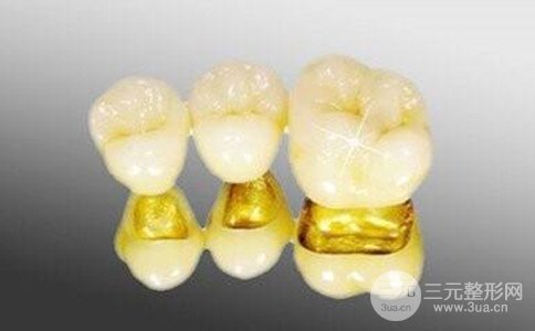 黄金烤瓷牙的寿命是几年、黄金烤瓷牙价格是多少