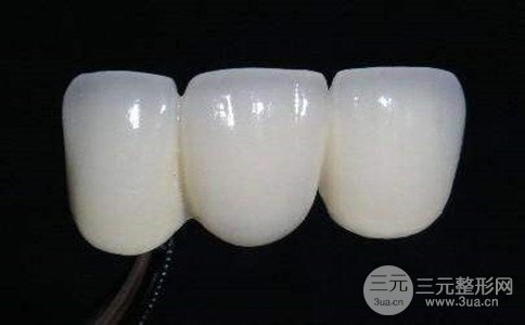 烤瓷牙多久换一次、做一颗烤瓷牙大概多少钱