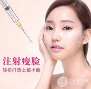 咬肌怎么变小  B****去除咬肌果怎么样