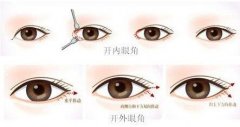 开眼角风险大吗