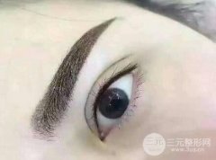 洗眉什么方法喜欢？激光洗眉的价格是多少？有什么注意事项？