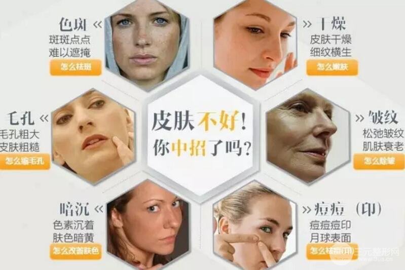 光子嫩肤