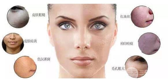 光子嫩肤有果吗?光子嫩肤做几次才有果?