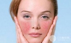 彩光祛红血丝要多少钱价格贵不贵