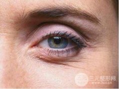 去除鱼尾纹的方法？去除鱼尾纹的方法有哪些？