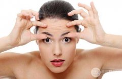 怎么去除表情纹?面部埋x+玻尿酸除皱真实案例图片分享~ 怎么去除表情纹?面部埋x+玻尿酸除皱真实案例图片分享~