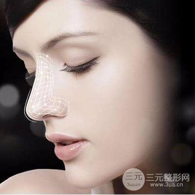 隆鼻什么材料好？隆鼻有哪些材料？