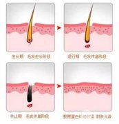 怎么去唇毛 激光去除唇毛怎么样 价格贵不贵