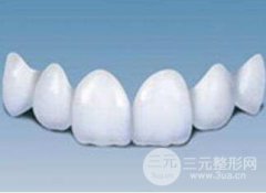 仿生美容冠怎么样 价格贵不贵