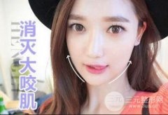 注射瘦脸瘦脸一针要多少钱 适合哪种脸型