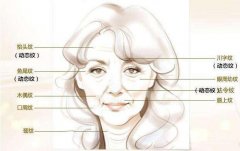 注射瘦脸去皱多少钱