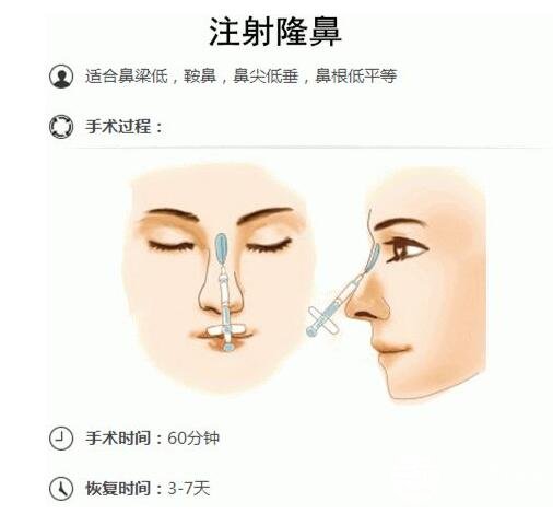 注射隆鼻的材料有哪些？优点有哪些？