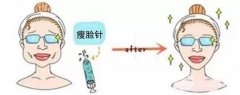 贵州注射瘦脸B****价格表 多久见