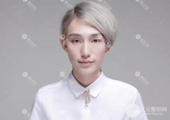 重庆华美打注射瘦脸B****多少钱？案例图片果分享
