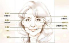 一针除皱多少钱 注射瘦脸除皱果好不好