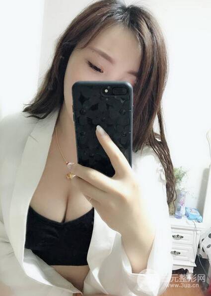 自体脂肪丰胸3个月分享，活细胞丰胸术后果逼真更自然