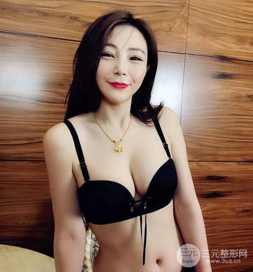 自体脂肪丰胸3个月分享，活细胞丰胸术后果逼真更自然