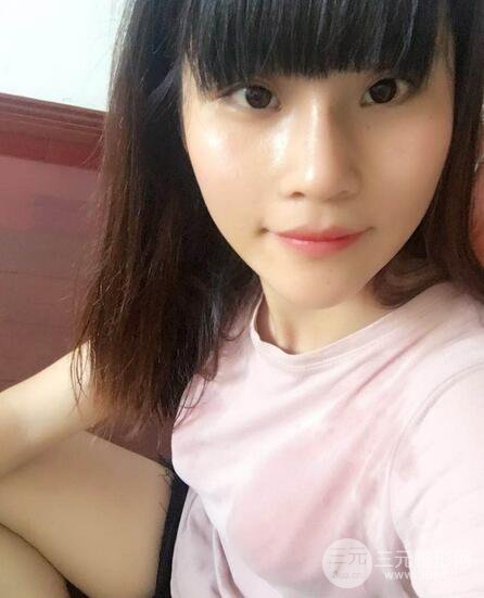 隆鼻鼻翼缩小全过程和术后照片分享，随意揉捏很OK