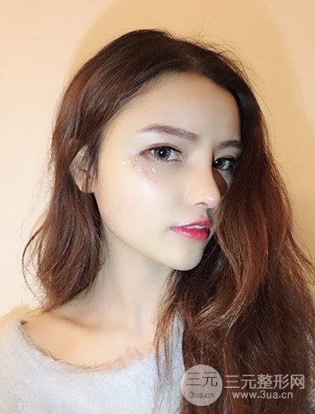 全脸自体脂肪填充+隆鼻整形果永.久保持、丑小鸭变天鹅不是梦