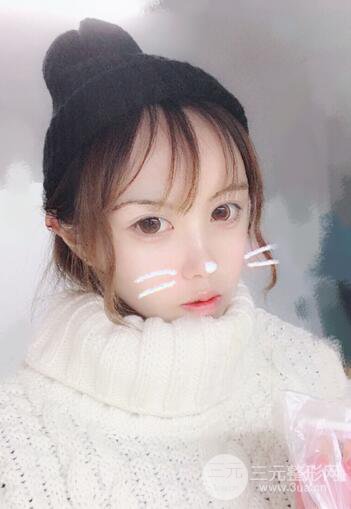 自体脂肪填充全脸基本换脸，改脸型不只是磨骨才能做到！