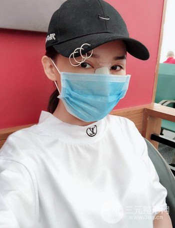 上海隆鼻失败手术修复果超乎想象、前后对比照片分享