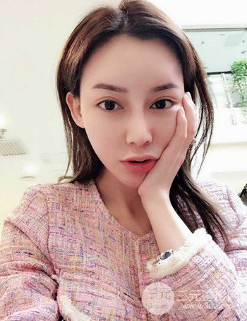 上海隆鼻失败手术修复果超乎想象、前后对比照片分享