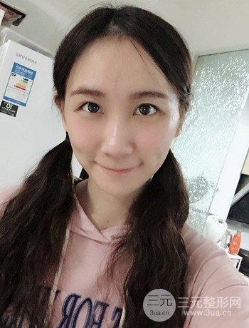 面部埋埋蛋白线.提升改良皮肤松弛，立现小V脸