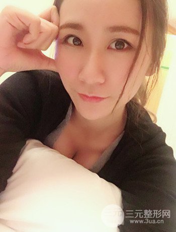 面部埋埋蛋白线.提升改良皮肤松弛，立现小V脸