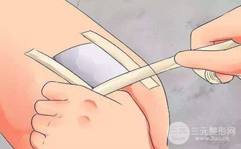 脂肪液化的原因是什么、脂肪液化如何恢复快