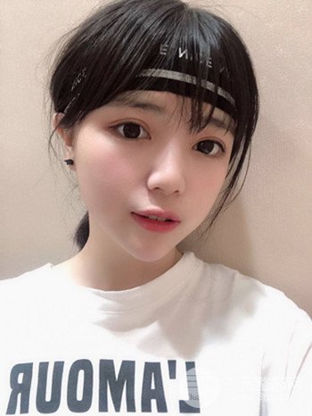 切开双眼皮开眼角果超赞、成功改良大小眼
