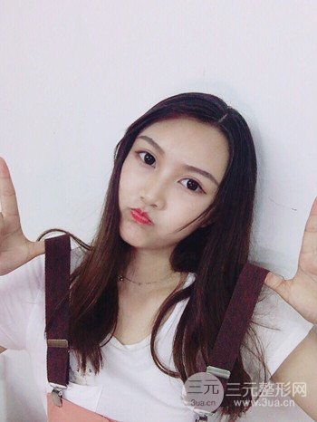 多面部自体脂肪填充前后对比图、果十分惊人