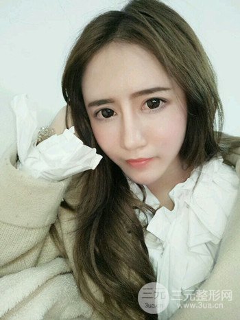 韦文峰自体脂肪面部填充手术案例分享、堪称减龄神器