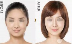 B****打几次定型 三次能定型嘛
