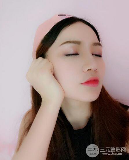 耳软骨隆鼻全过程及术后果分享