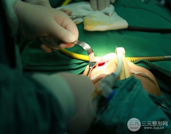 【下颌角+颧骨+下巴】全脸磨骨整形