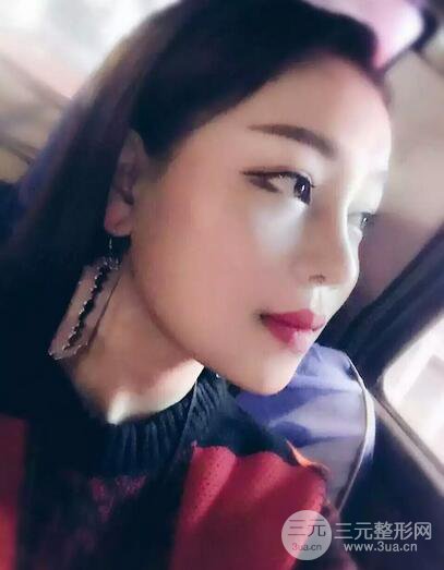 【下颌角+颧骨+下巴】全脸磨骨整形