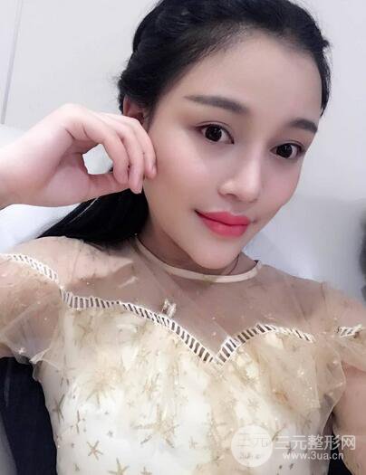 【下颌角+颧骨+下巴】全脸磨骨整形