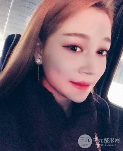 【下颌角+颧骨+下巴】全脸磨骨整形