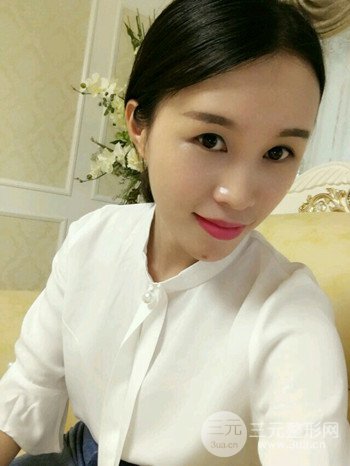 韦文峰全脸脂肪填充日记分享,前后图片对比