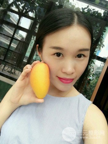 韦文峰全脸脂肪填充日记分享,前后图片对比