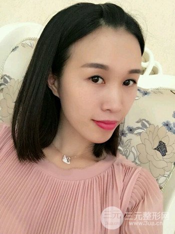 韦文峰全脸脂肪填充日记分享,前后图片对比