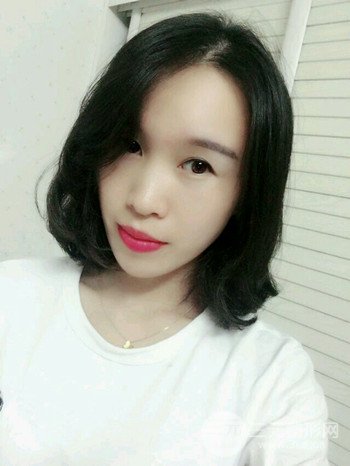 韦文峰全脸脂肪填充日记分享,前后图片对比