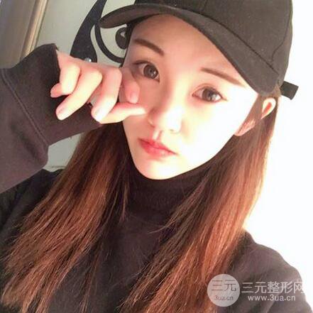 下颌角磨骨整形全过程分享,附上术后恢复照片~